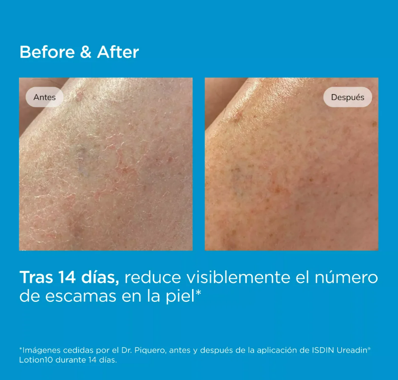 UREADIN RX 10 REPARADORA BOTELLA 200 ML.