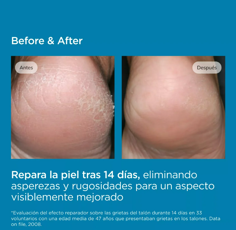 UREADIN PODOS GEL OIL 75 ML.