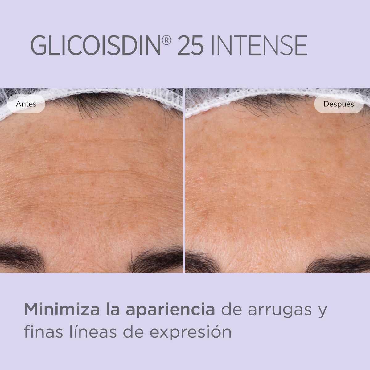ISDINCEUTICS GLICOISDIN INTENSE GEL 25% 50 ML.