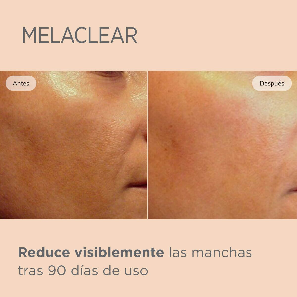 ISDINCEUTICS MELACLEAR 15 ML.