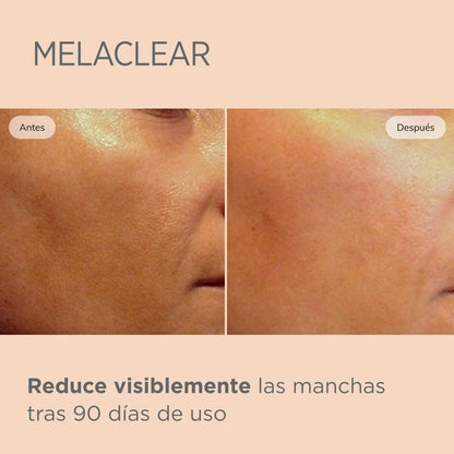 ISDINCEUTICS MELACLEAR 15 ML.
