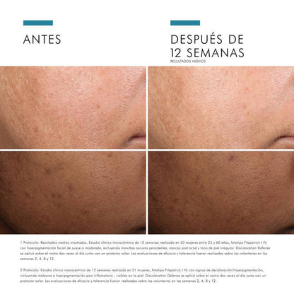 DISCOLORATION DEFENSE 30 ML.